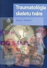 Traumatologia skeletu tvare 